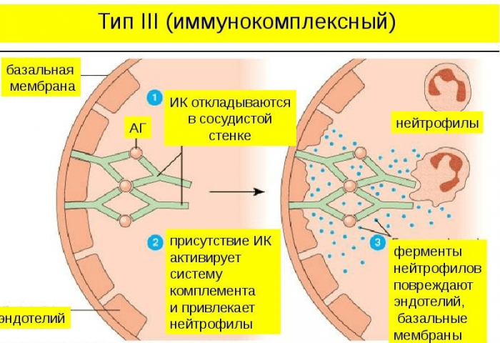 alerg ya u nemovlyati yak proyavlya t sya yak viglyada nemovlya p d chas hvorobi n zh l kuvati prof laktika 9 - Алергія у немовляти: як проявляється, як виглядає немовля під час хвороби, ніж лікувати, профілактика