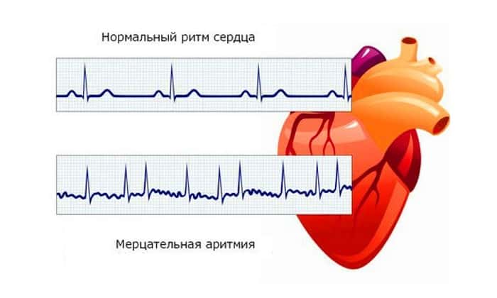 amfocil nstrukc ya z zastosuvannya c na v dguki analogi 13 - АМФОЦИЛ – інструкція із застосування, ціна, відгуки і аналоги