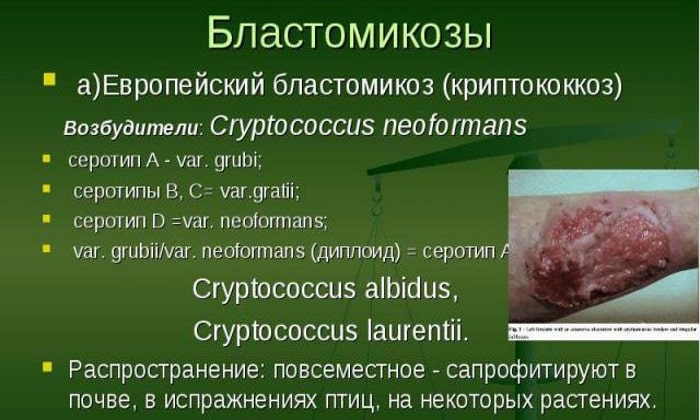 АМФОЦИЛ – інструкція із застосування, ціна, відгуки і аналоги amfocil nstrukc ya z zastosuvannya c na v dguki analogi 4 - АМФОЦИЛ – інструкція із застосування, ціна, відгуки і аналоги