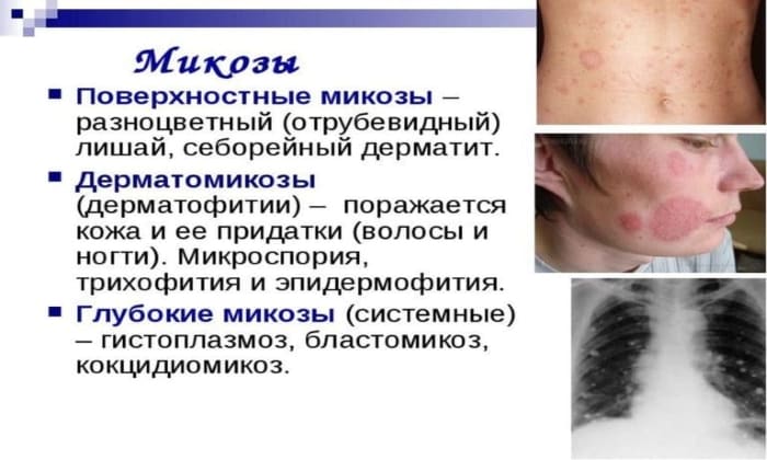 АМФОЦИЛ – інструкція із застосування, ціна, відгуки і аналоги amfocil nstrukc ya z zastosuvannya c na v dguki analogi 5 - АМФОЦИЛ – інструкція із застосування, ціна, відгуки і аналоги