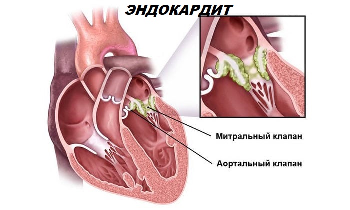 amfolip nstrukc ya z zastosuvannya c na v dguki analogi 4 - АМФОЛИП – інструкція із застосування, ціна, відгуки і аналоги