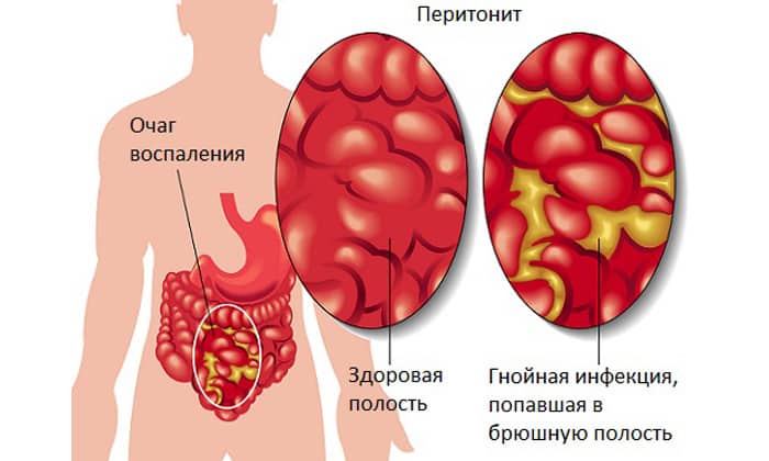 amfolip nstrukc ya z zastosuvannya c na v dguki analogi 5 - АМФОЛИП – інструкція із застосування, ціна, відгуки і аналоги