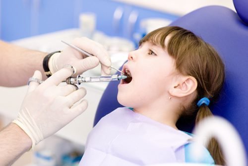 anestez ya v dityach y stomatolog pri l kuvann zub v preparati narkoz 4 - Анестезія в дитячій стоматології при лікуванні зубів: препарати, наркоз