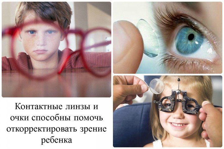 astigmatizm u d tey l kuvannya simptomi prichini vidi foto v deo 5 - Астигматизм у дітей: лікування, симптоми, причини, види, фото і відео