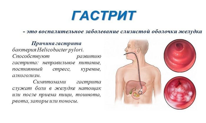БІСЕПТОЛ 120 – інструкція із застосування, ціна, відгуки і аналоги b septol 120 nstrukc ya z zastosuvannya c na v dguki analogi 7 - БІСЕПТОЛ 120 – інструкція із застосування, ціна, відгуки і аналоги