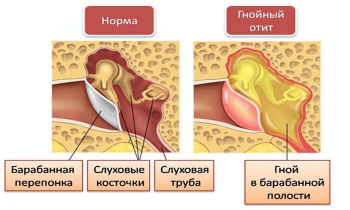 b septol 240 nstrukc ya z zastosuvannya c na v dguki analogi 5 - БІСЕПТОЛ 240 – інструкція із застосування, ціна, відгуки і аналоги