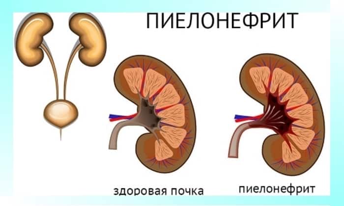b septol 240 nstrukc ya z zastosuvannya c na v dguki analogi 6 - БІСЕПТОЛ 240 – інструкція із застосування, ціна, відгуки і аналоги