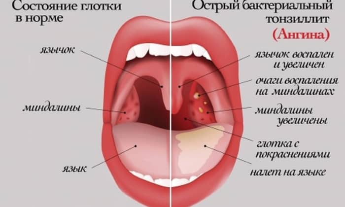 b septol 240 nstrukc ya z zastosuvannya c na v dguki analogi 8 - БІСЕПТОЛ 240 – інструкція із застосування, ціна, відгуки і аналоги