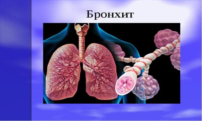 b septol 480 nstrukc ya z zastosuvannya c na v dguki analogi 11 - БІСЕПТОЛ 480 – Інструкція із застосування, ціна, відгуки і аналоги