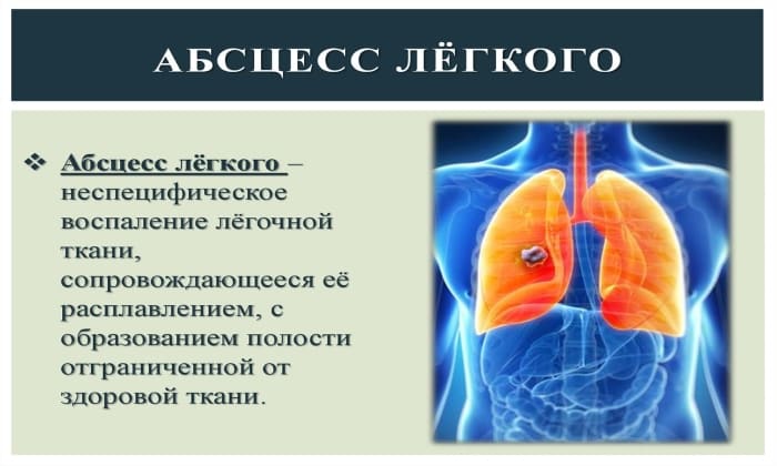 b septol 480 nstrukc ya z zastosuvannya c na v dguki analogi 13 - БІСЕПТОЛ 480 – Інструкція із застосування, ціна, відгуки і аналоги