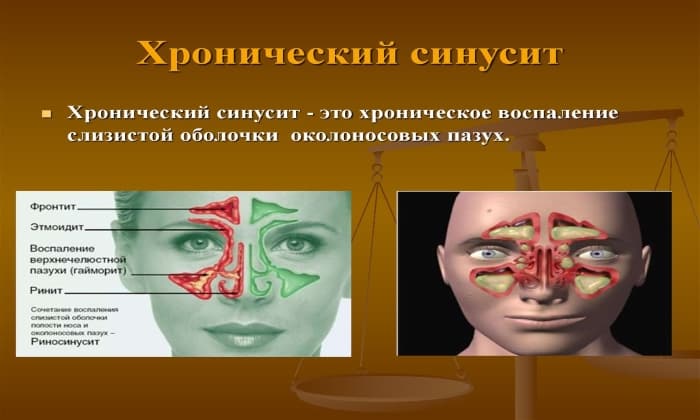 b septol 480 nstrukc ya z zastosuvannya c na v dguki analogi 14 - БІСЕПТОЛ 480 – Інструкція із застосування, ціна, відгуки і аналоги