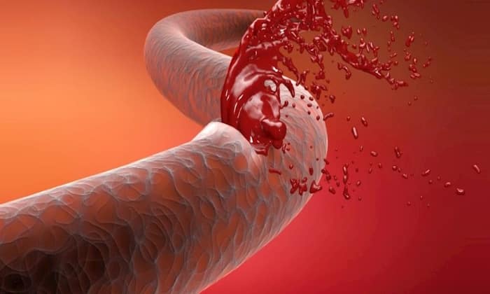 b septol 480 nstrukc ya z zastosuvannya c na v dguki analogi 32 - БІСЕПТОЛ 480 – Інструкція із застосування, ціна, відгуки і аналоги