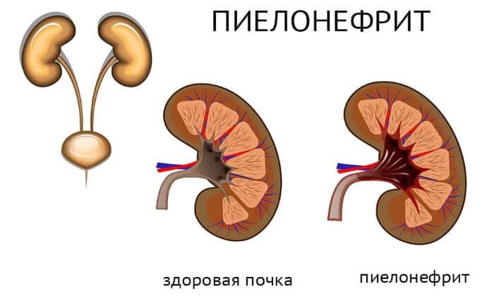 b septol 480 nstrukc ya z zastosuvannya c na v dguki analogi 5 - БІСЕПТОЛ 480 – Інструкція із застосування, ціна, відгуки і аналоги