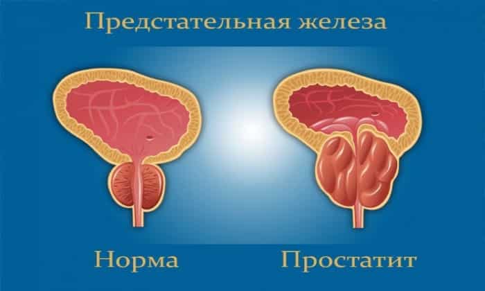 b septol 480 nstrukc ya z zastosuvannya c na v dguki analogi 6 - БІСЕПТОЛ 480 – Інструкція із застосування, ціна, відгуки і аналоги