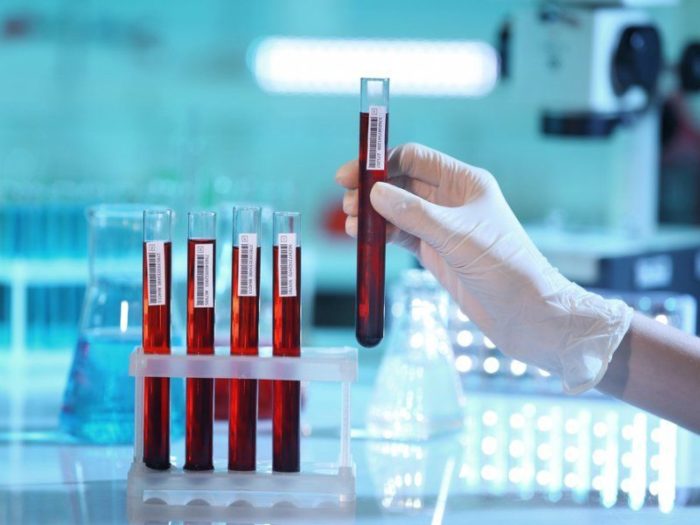 beshihove zapalennya shk ri oblichchya simptomi metodi l kuvannya foto piki zahodi prof laktiki ta prognoz 12 - Бешихове запалення шкіри обличчя: симптоми, методи лікування, фото пики, заходи профілактики та прогноз