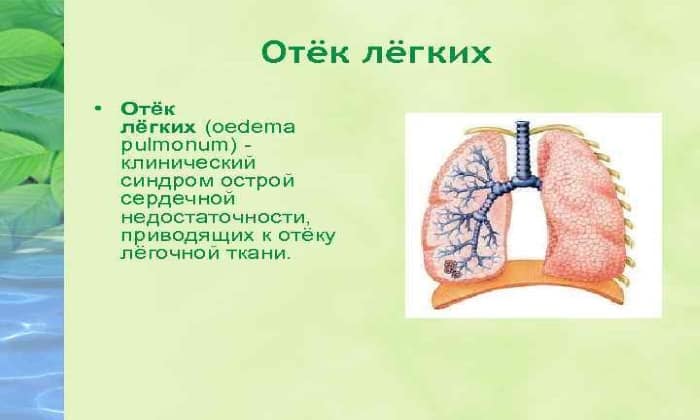 betadin 10 nstrukc ya z zastosuvannya c na v dguki analogi 12 - БЕТАДИН 10 – інструкція із застосування, ціна, відгуки і аналоги