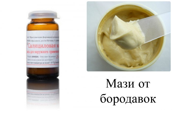 borodavki u ditini na rukah prichini poyavi vidalennya zas b v d borodavok foto v deo 3 - Бородавки у дитини на руках: причини появи, видалення, засіб від бородавок, фото і відео