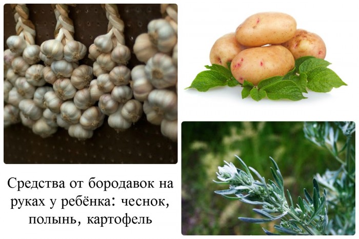 borodavki u ditini na rukah prichini poyavi vidalennya zas b v d borodavok foto v deo 4 - Бородавки у дитини на руках: причини появи, видалення, засіб від бородавок, фото і відео