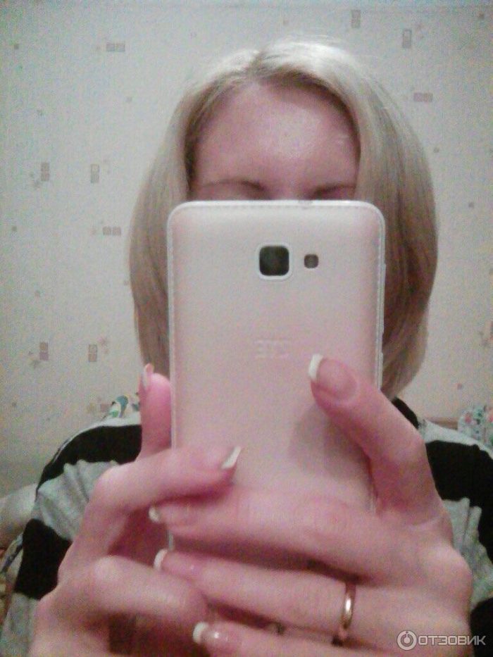 botoks abo disport yak vibrati v dm nnost scho dovshe trima t sya nsh aspekti v dguki 5 - Ботокс або Диспорт: як вибрати, відмінності, що довше тримається і інші аспекти + відгуки