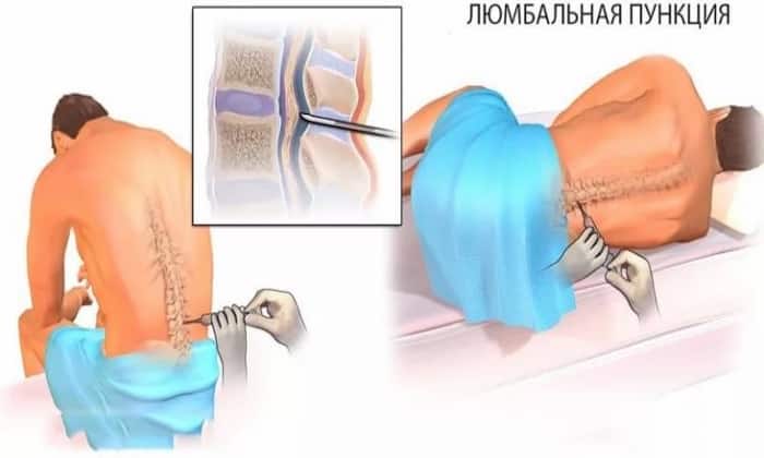 БРАУНОДИН Б. БРАУН – інструкція із застосування, ціна, відгуки і аналоги braunodin b braun nstrukc ya z zastosuvannya c na v dguki analogi 4 - БРАУНОДИН Б. БРАУН – інструкція із застосування, ціна, відгуки і аналоги