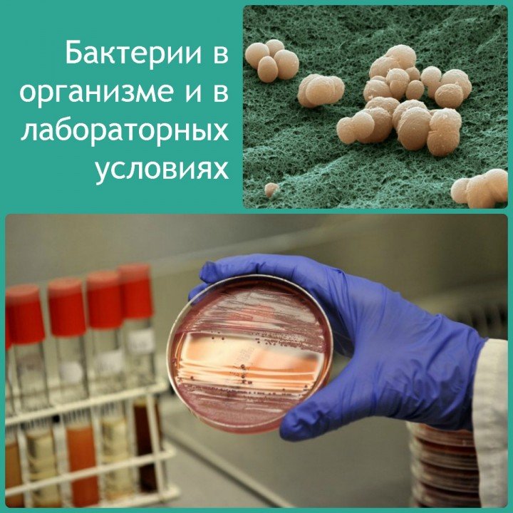 chim nebezpechniy sindrom nadlishkovogo bakter al nogo rostu yak v d n ogo pozbavitisya v deo scho take disbakter oz 3 - Чим небезпечний синдром надлишкового бактеріального росту і як від нього позбавитися, відео, що таке дисбактеріоз