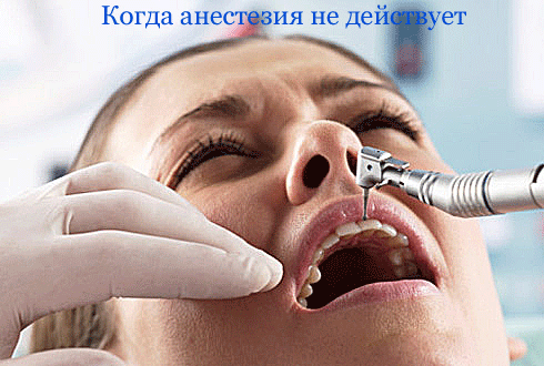 chomu ne d anestez ya pri l kuvann zub v prichini scho robiti 1 - Чому не діє анестезія при лікуванні зубів, причини, що робити