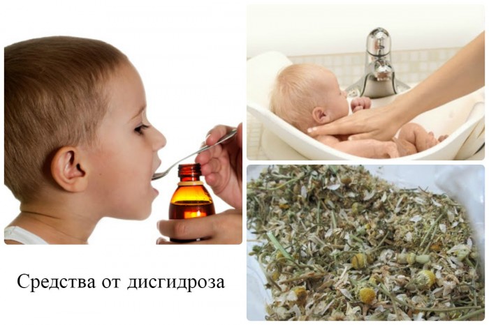 disg droz kistey ruk stop u d tey simptomi l kuvannya prof laktika foto 5 - Дисгідрозі кистей рук і стоп у дітей: симптоми, лікування, профілактика, фото