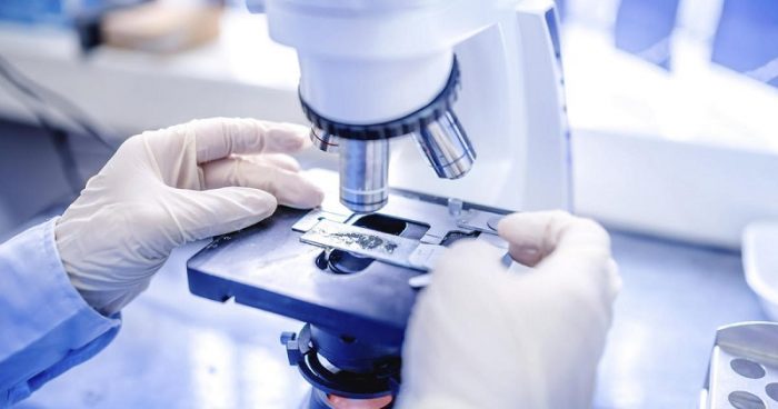 displastichniy nevus scho ce take foto prichini simptomi d agnostika metodi l kuvannya vidalennya 12 - Диспластичний невус: що це таке, фото, причини, симптоми, діагностика, методи лікування і видалення