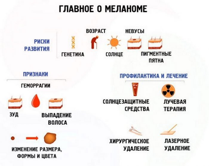 displastichniy nevus scho ce take foto prichini simptomi d agnostika metodi l kuvannya vidalennya 6 - Диспластичний невус: що це таке, фото, причини, симптоми, діагностика, методи лікування і видалення
