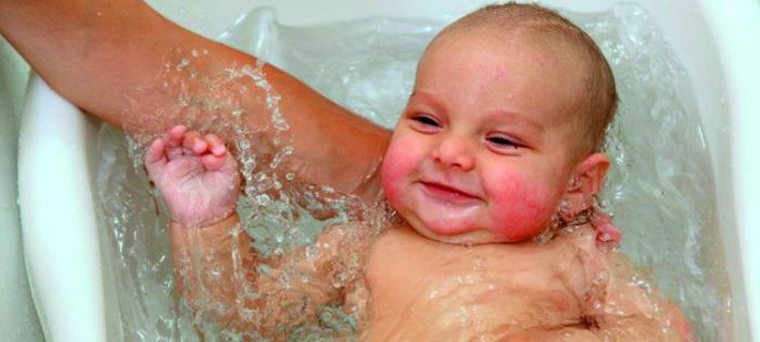 ditina sil no pot prichini chomu vinika p tliv st d agnostika l kuvannya uskladnennya prof laktika 7 - Дитина сильно потіє: причини (чому виникає пітливість), діагностика, лікування, ускладнення, профілактика