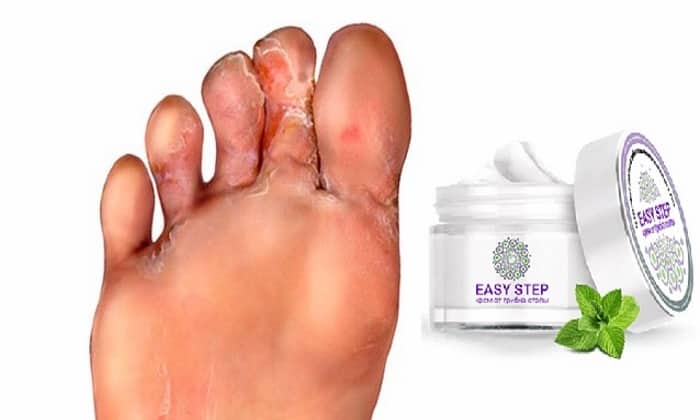EASY STEP від ГРИБКА: відгуки, ціна, склад і чи варто купувати easy step v d gribka v dguki c na sklad chi varto kupuvati 3 - EASY STEP від ГРИБКА: відгуки, ціна, склад і чи варто купувати