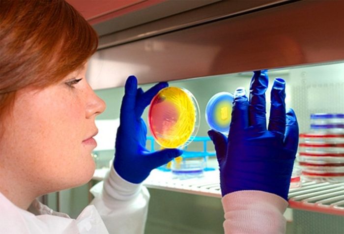 eksfol ativniy dermatit r ttera u doroslih d tey u tomu chisl novonarodzhenih foto 6 - Ексфоліативний дерматит (Ріттера) у дорослих і дітей, у тому числі новонароджених, фото
