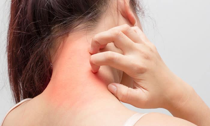 ekzo derm nstrukc ya z zastosuvannya c na v dguki analogi 5 - ЕКЗО-ДЕРМ – інструкція із застосування, ціна, відгуки і аналоги