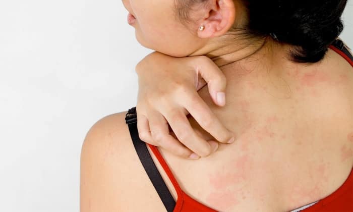 ekzo derm nstrukc ya z zastosuvannya c na v dguki analogi 8 - ЕКЗО-ДЕРМ – інструкція із застосування, ціна, відгуки і аналоги