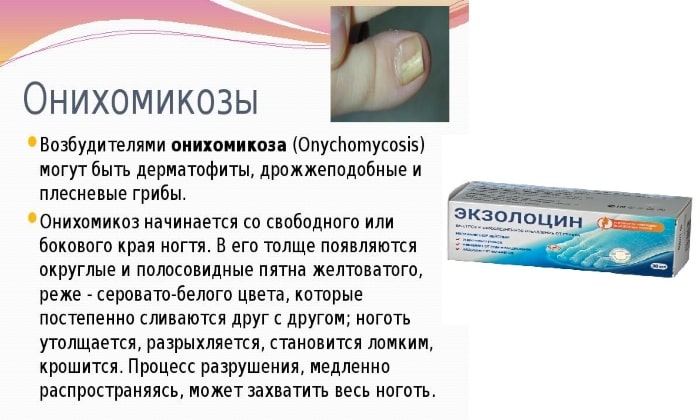 Онихомикоз лечение схема