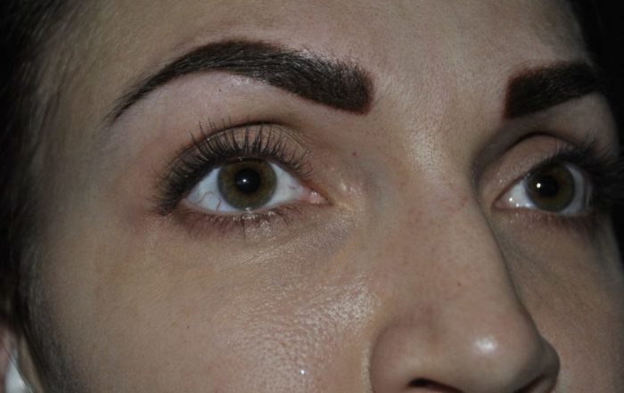 etapi zago nnya p slya tatuazhu abo permanentnogo mak yazhu br v po dnyah foto do p slya proceduri v tomu chisl cherez m syac v dguki 5 - Етапи загоєння після татуажу або перманентного макіяжу брів по днях: фото до і після процедури, в тому числі через місяць, відгуки