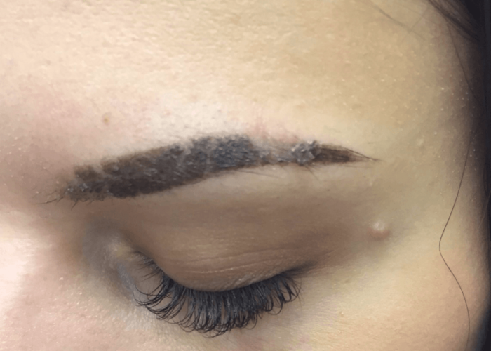 etapi zago nnya p slya tatuazhu abo permanentnogo mak yazhu br v po dnyah foto do p slya proceduri v tomu chisl cherez m syac v dguki 8 - Етапи загоєння після татуажу або перманентного макіяжу брів по днях: фото до і після процедури, в тому числі через місяць, відгуки
