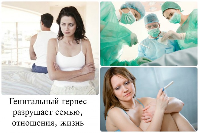gen tal niy gerpes prichini simptomi d agnostika l kuvannya foto v deo 5 - Генітальний герпес – причини, симптоми, діагностика і лікування, фото, відео