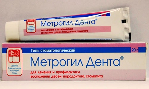 ХОЛИСАЛ або МЕТРОГІЛ ДЕНТА: що краще і в чому різниця (відмінність складів, відгуки лікарів) holisal abo metrog l denta scho krasche v chomu r znicya v dm nn st sklad v v dguki l kar v 5 - ХОЛИСАЛ або МЕТРОГІЛ ДЕНТА: що краще і в чому різниця (відмінність складів, відгуки лікарів)