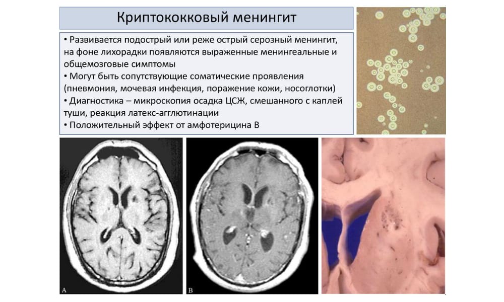 itral nstrukc ya z zastosuvannya c na v dguki analogi 3 - ИТРАЛ – інструкція із застосування, ціна, відгуки і аналоги