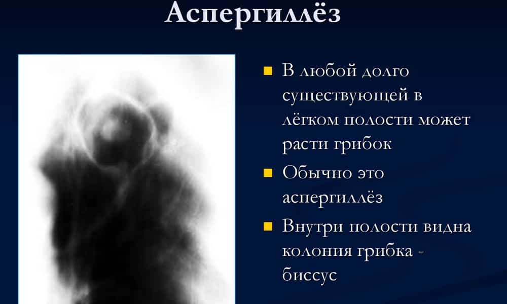 itral nstrukc ya z zastosuvannya c na v dguki analogi 4 - ИТРАЛ – інструкція із застосування, ціна, відгуки і аналоги