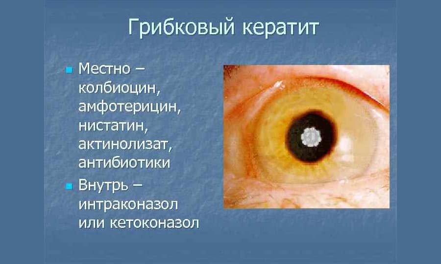 itral nstrukc ya z zastosuvannya c na v dguki analogi 6 - ИТРАЛ – інструкція із застосування, ціна, відгуки і аналоги