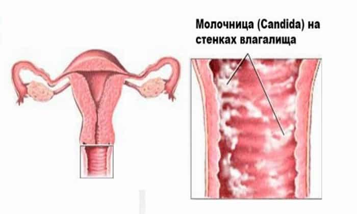 КАНДИД Б – Інструкція із застосування, ціна, відгуки і аналоги kandid b nstrukc ya z zastosuvannya c na v dguki analogi 11 - КАНДИД Б – Інструкція із застосування, ціна, відгуки і аналоги