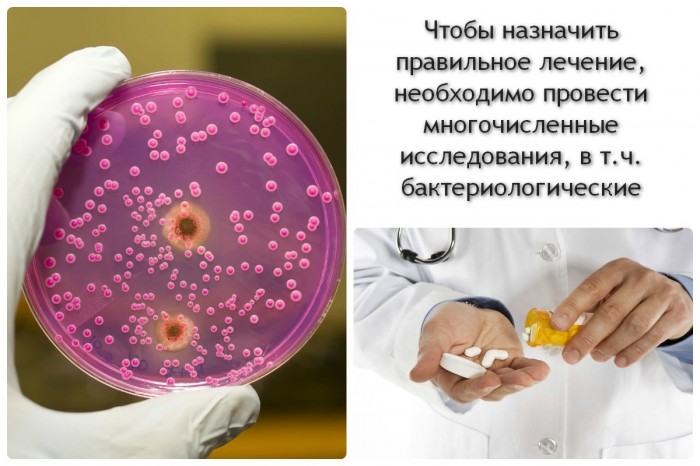kandidoz prichini simptomi d agnostika l kuvannya uskladnennya v deo pro l kuvannya kandidozu u zh nok 5 - Кандидоз: причини, симптоми, діагностика, лікування, ускладнення, відео про лікування кандидозу у жінок