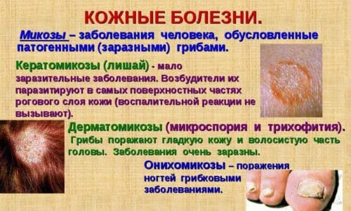 КАНДИЗОЛ – інструкція із застосування, ціна, відгуки і аналоги kandizol nstrukc ya z zastosuvannya c na v dguki analogi 3 - КАНДИЗОЛ – інструкція із застосування, ціна, відгуки і аналоги
