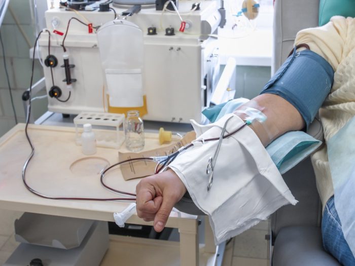 kaplevidniy krapel niy psor az l kuvannya v tomu chisl v domashn h umovah prichini ta d agnostika 12 - Каплевидний (крапельний) псоріаз: лікування, в тому числі в домашніх умовах, причини та діагностика