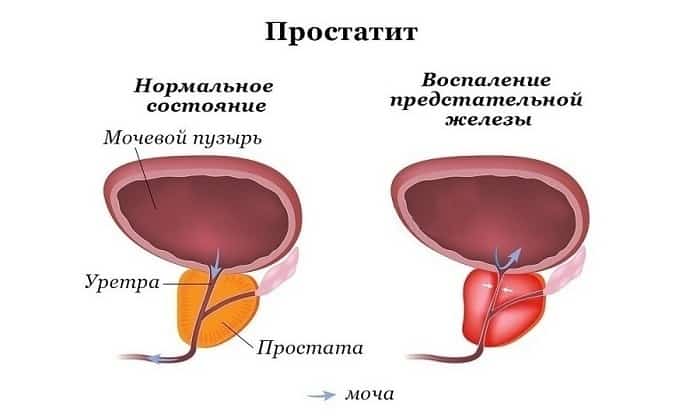ko trimoksazol nstrukc ya z zastosuvannya c na v dguki analogi 6 - КО-ТРИМОКСАЗОЛ – інструкція із застосування, ціна, відгуки і аналоги