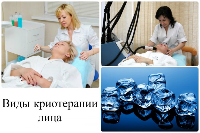 kr oterap ya osobi pokazannya osoblivost nasl dki foto v deo 2 - Кріотерапія особи: показання, особливості, наслідки, фото і відео
