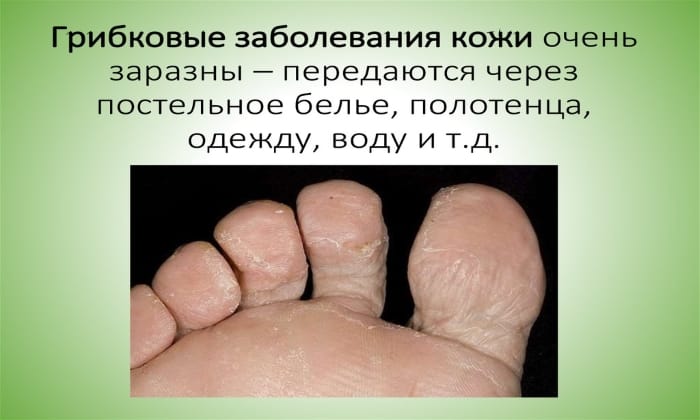lam zil 250 nstrukc ya z zastosuvannya c na v dguki analogi 5 - ЛАМІЗИЛ 250 – інструкція із застосування, ціна, відгуки і аналоги