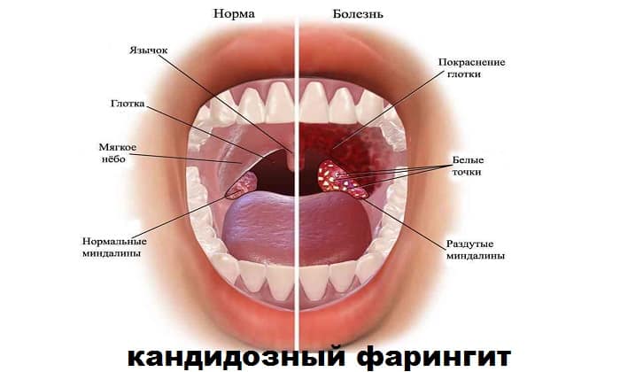 ЛАМИТЕЛЬ – інструкція із застосування, ціна, відгуки і аналоги lamitel nstrukc ya z zastosuvannya c na v dguki analogi 1 - ЛАМИТЕЛЬ – інструкція із застосування, ціна, відгуки і аналоги